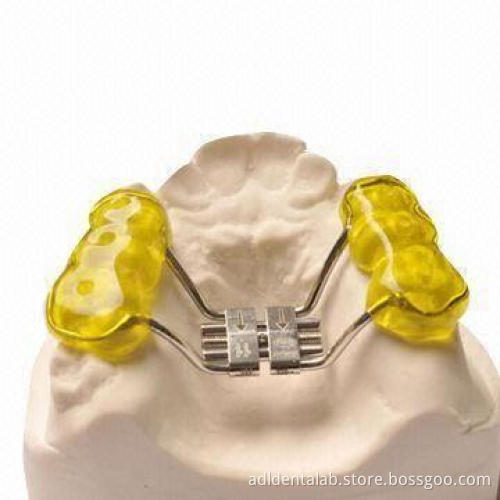 Rapid Maxillary Expander